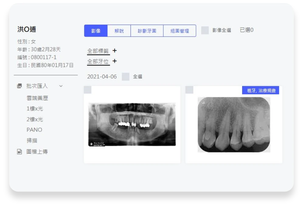 口腔影像管理畫面